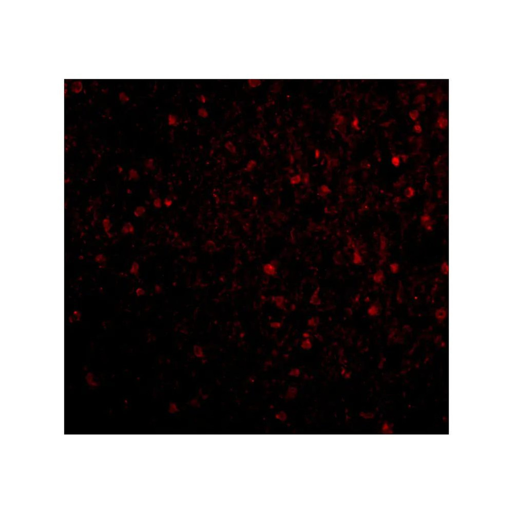 ProSci 4085 BRSK2 Antibody