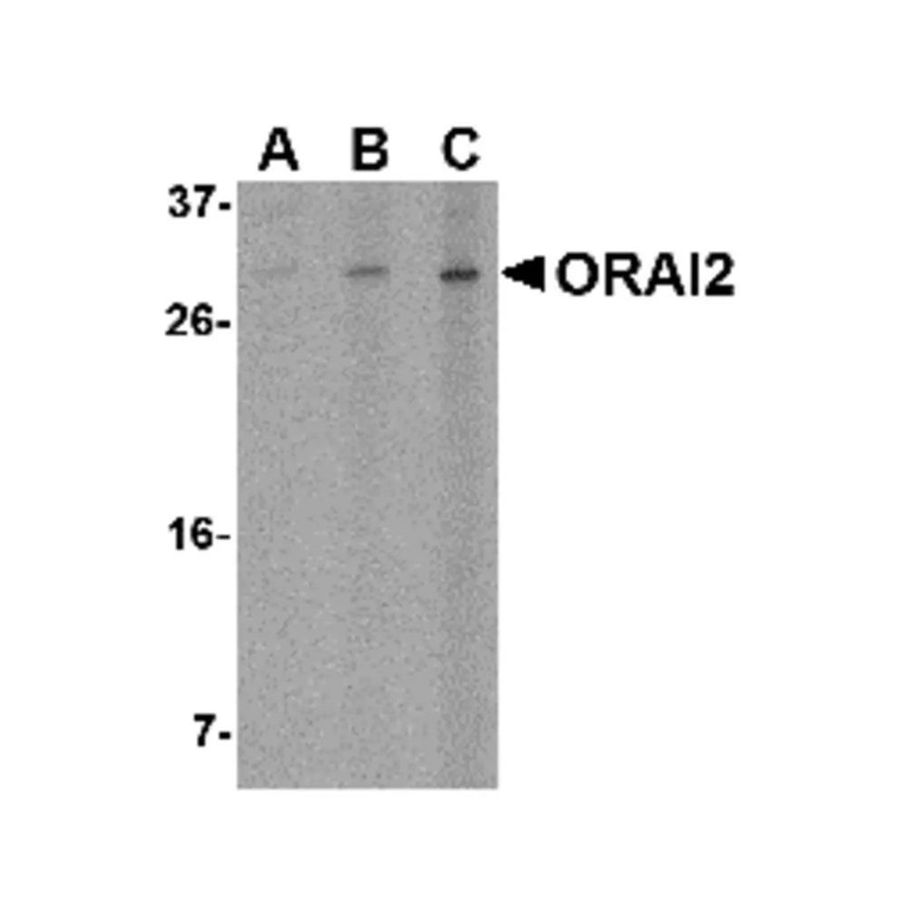 ProSci 4111 ORAI2 Antibody