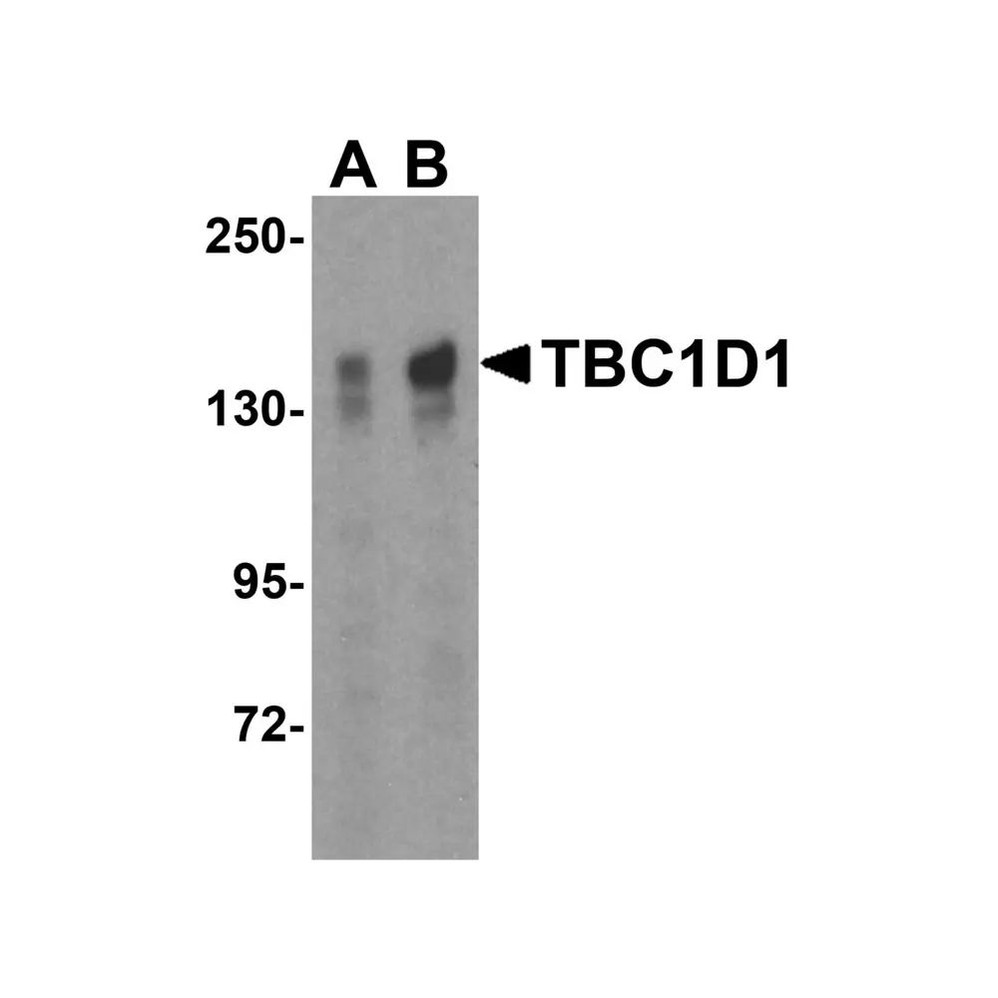 ProSci 4231 TBC1D1 Antibody