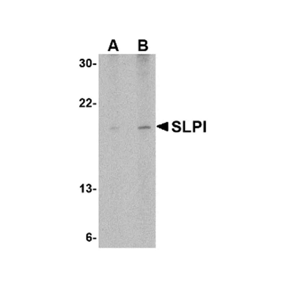 ProSci 4249 SLPI Antibody