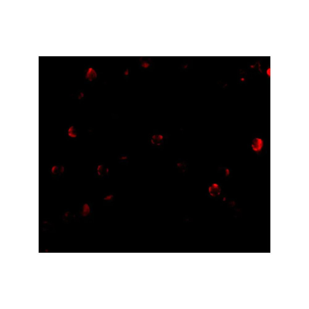 ProSci 4283 TDP43 Antibody
