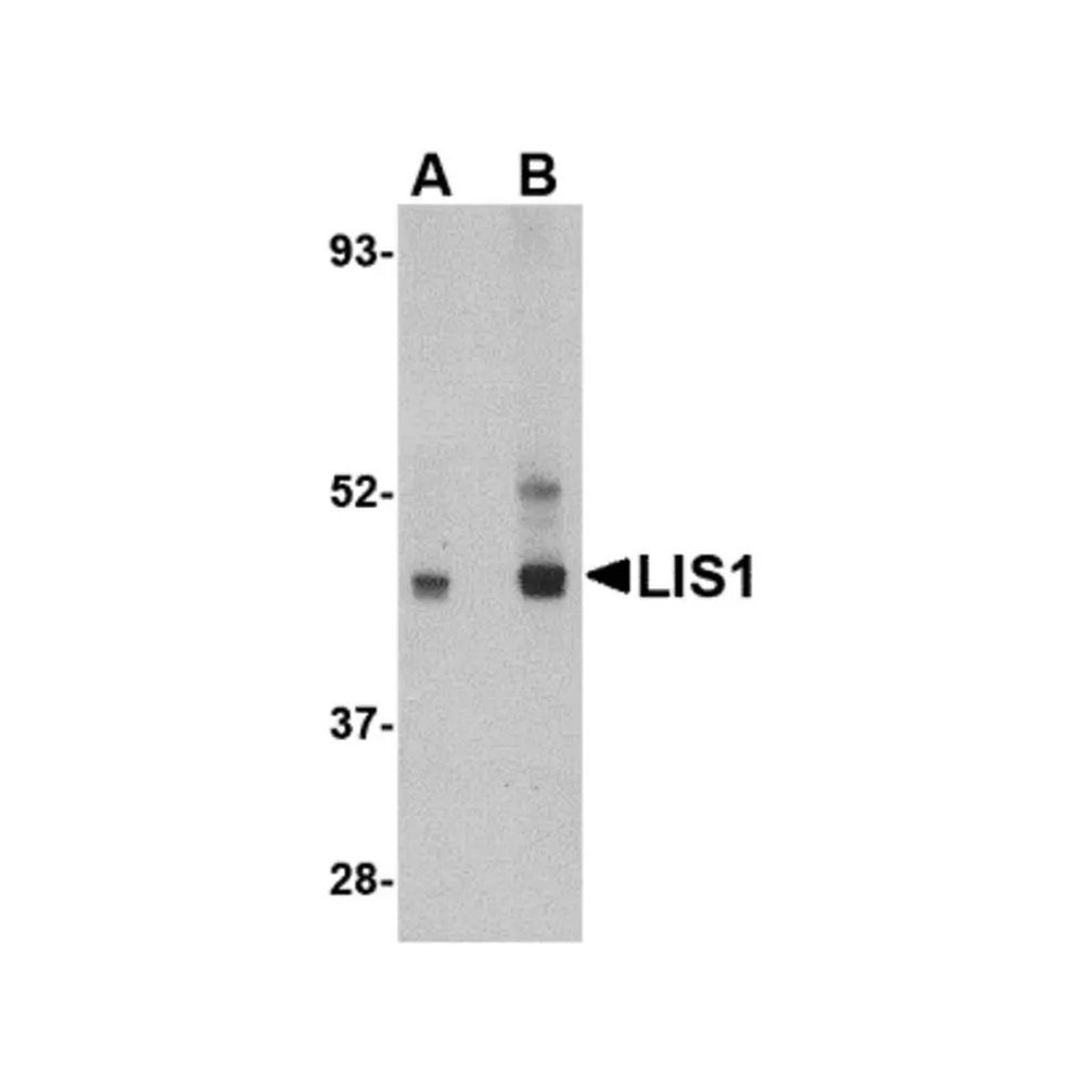 ProSci 4287 LIS1 Antibody