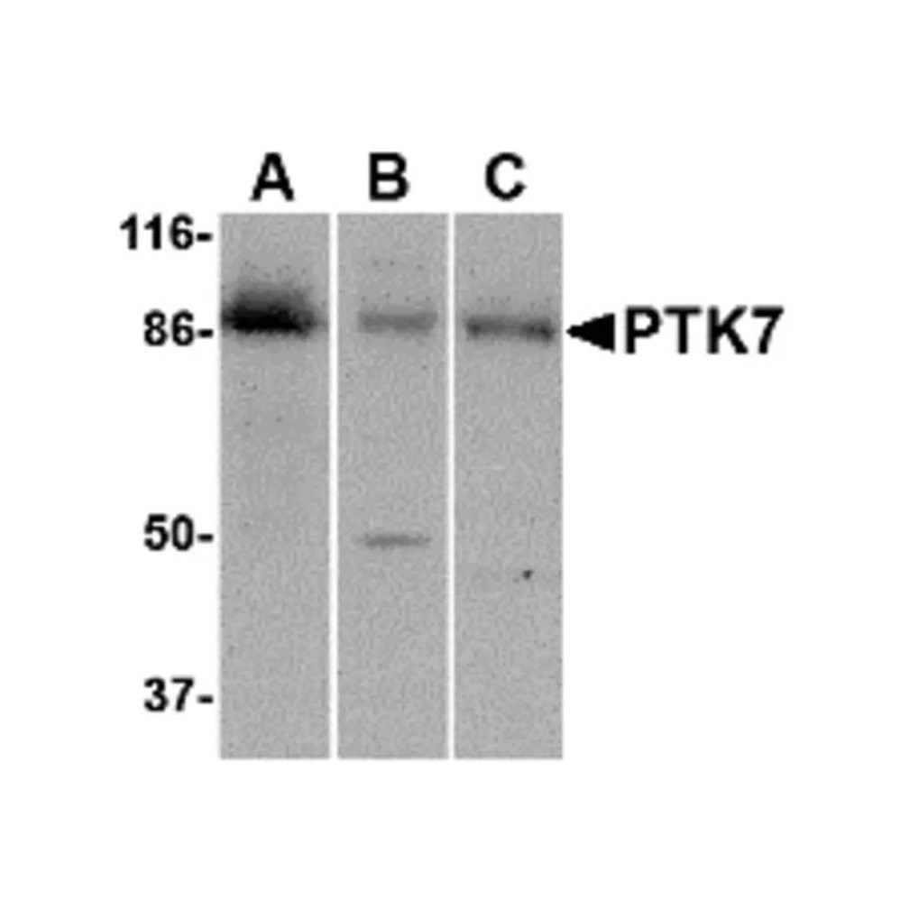 ProSci 4297 PTK7 Antibody