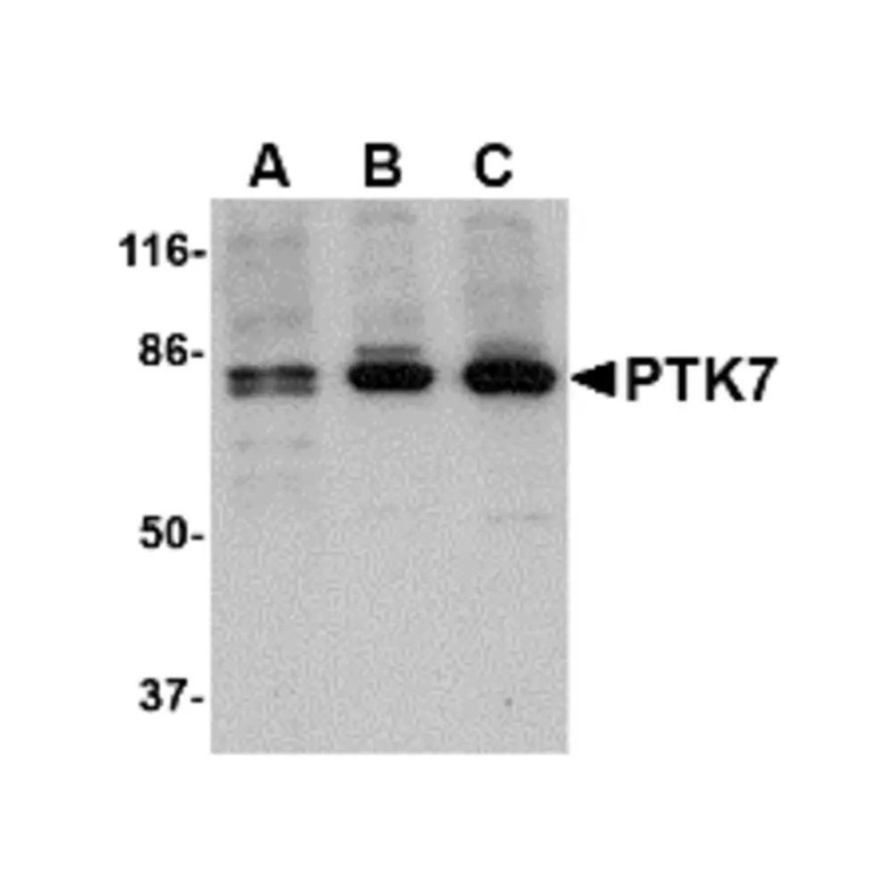 ProSci 4299 PTK7 Antibody
