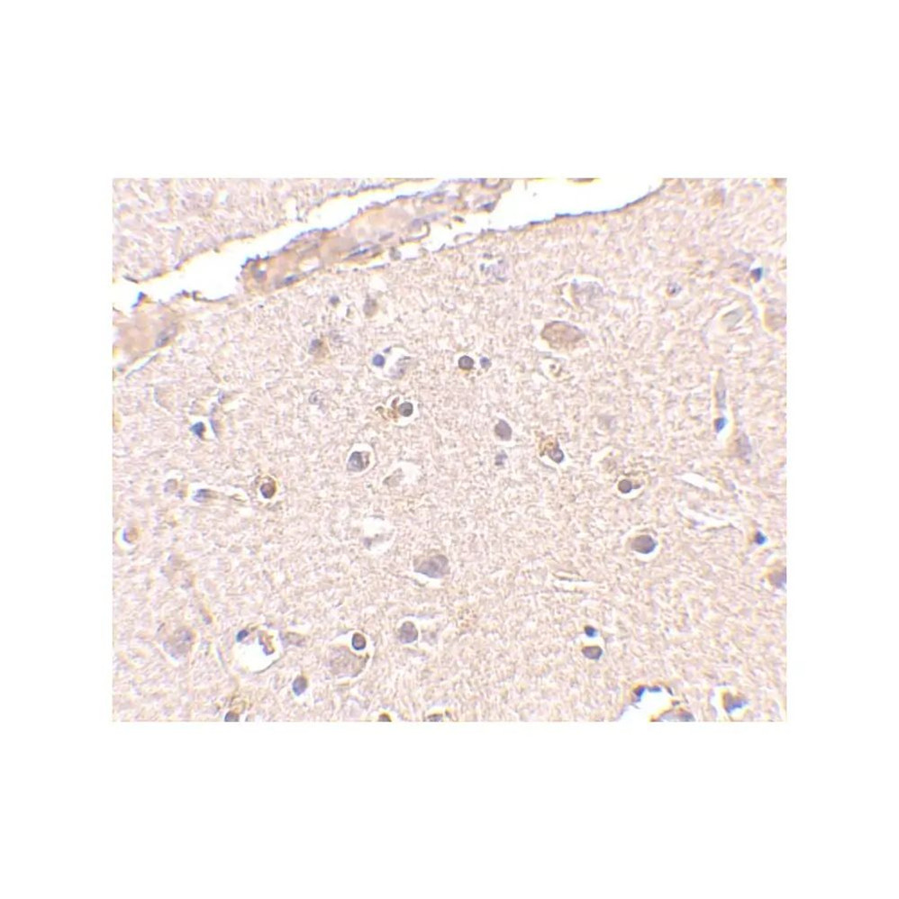 ProSci 4331 BRCC36 Antibody