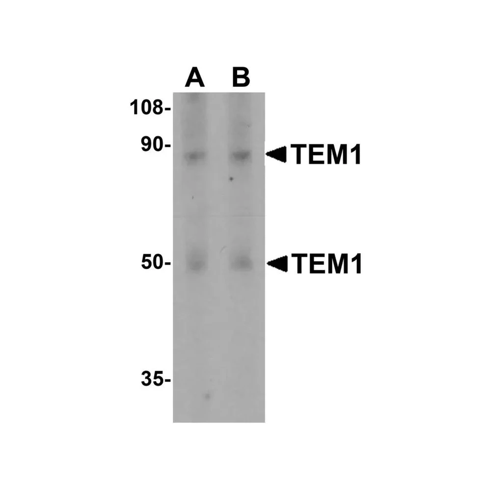 ProSci 4357 TEM1 Antibody