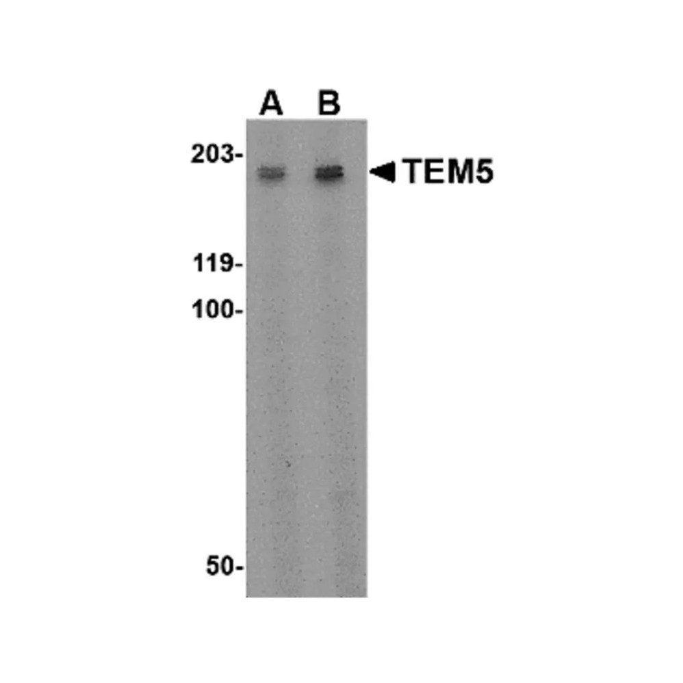 ProSci 4371 TEM5 Antibody