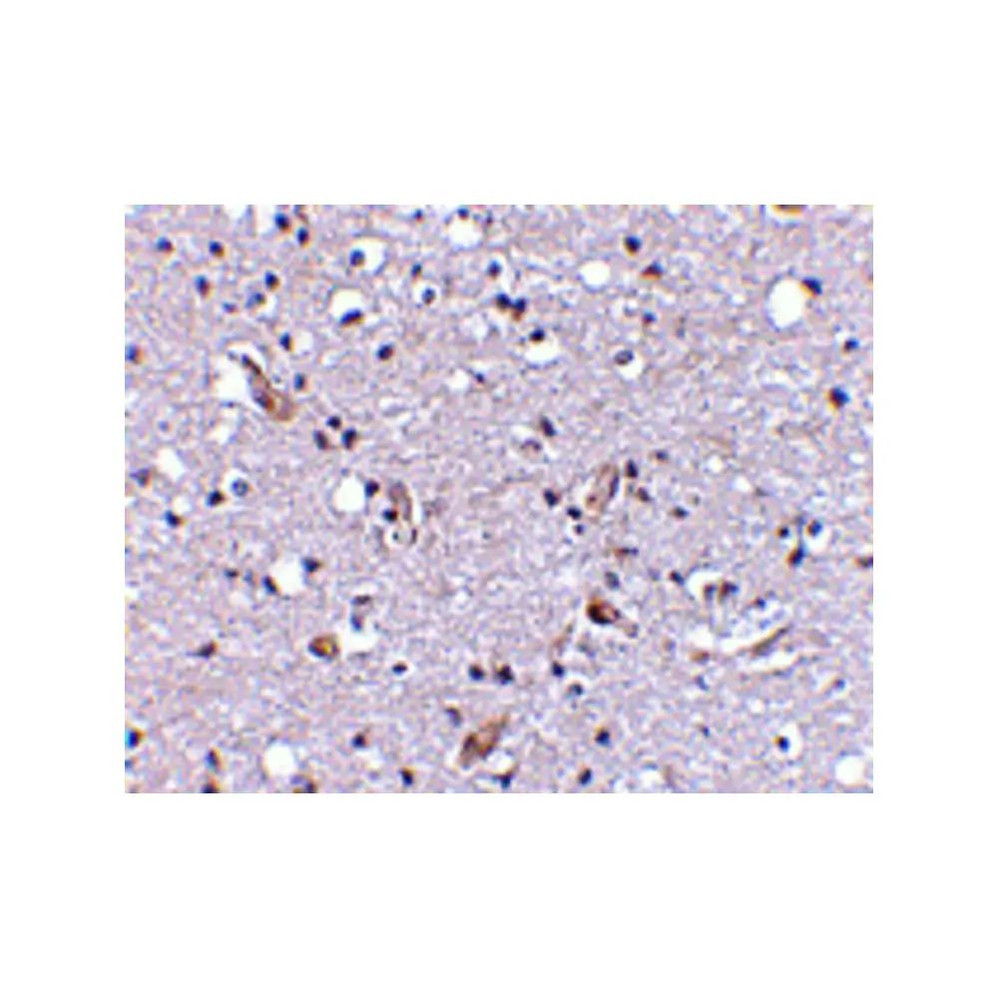 ProSci 4377 Nhe-1 Antibody