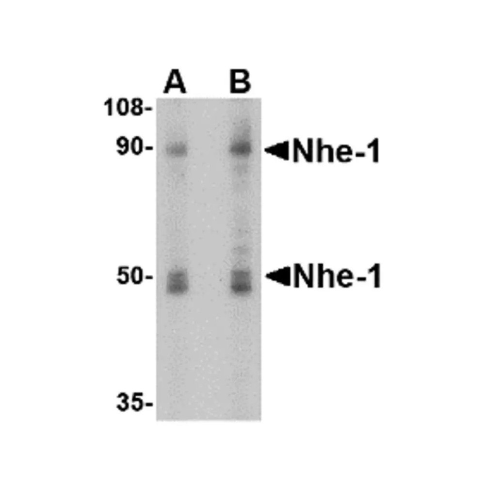 ProSci 4379 Nhe-1 Antibody