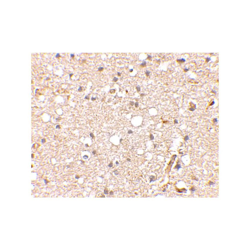 ProSci 4383 Grik1 Antibody
