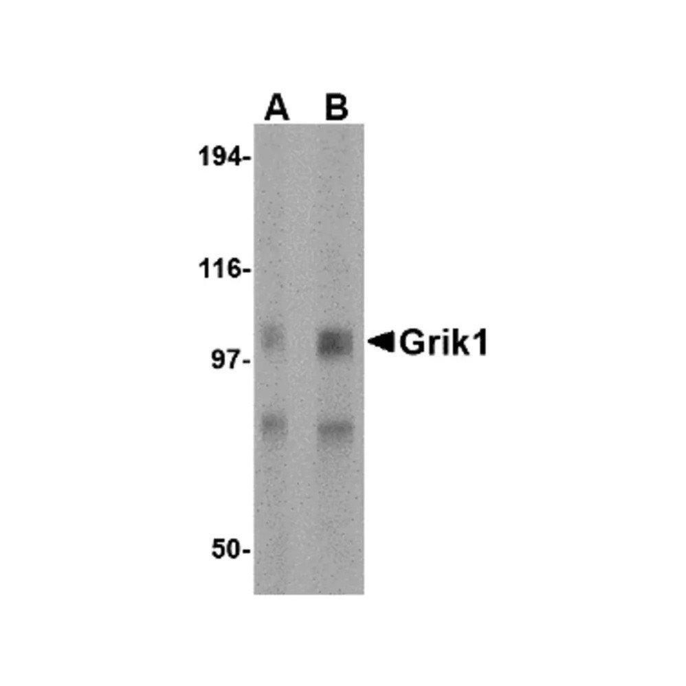 ProSci 4383 Grik1 Antibody