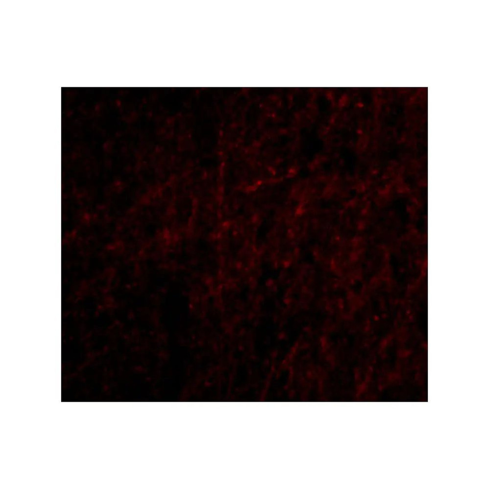ProSci 4417 Plxdc2 Antibody