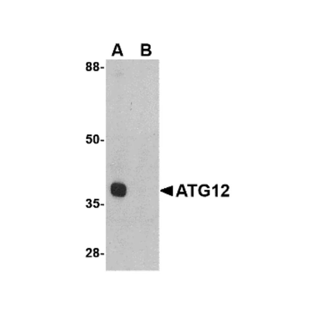 ProSci 4423 ATG12 Antibody