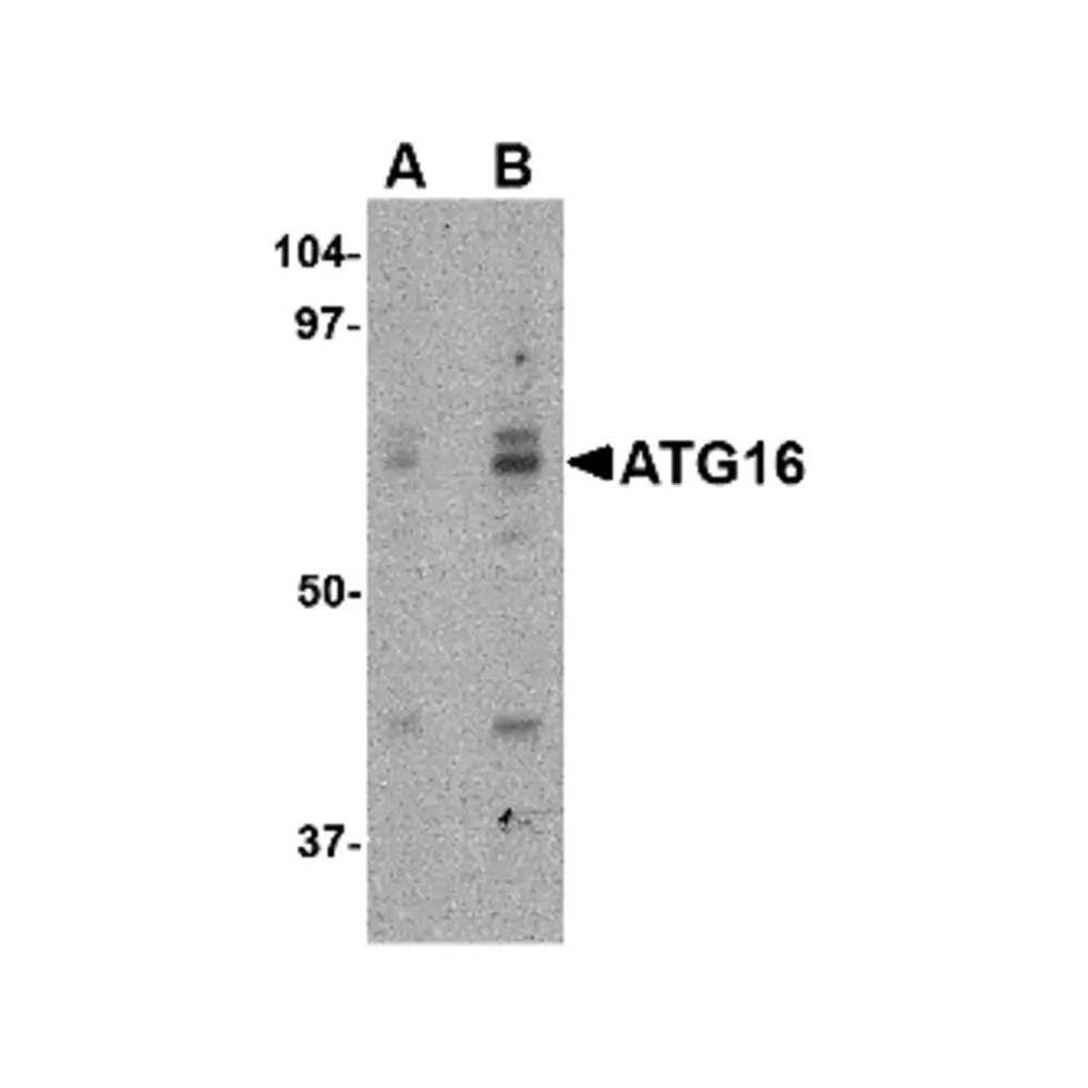 ProSci 4427 ATG16 Antibody