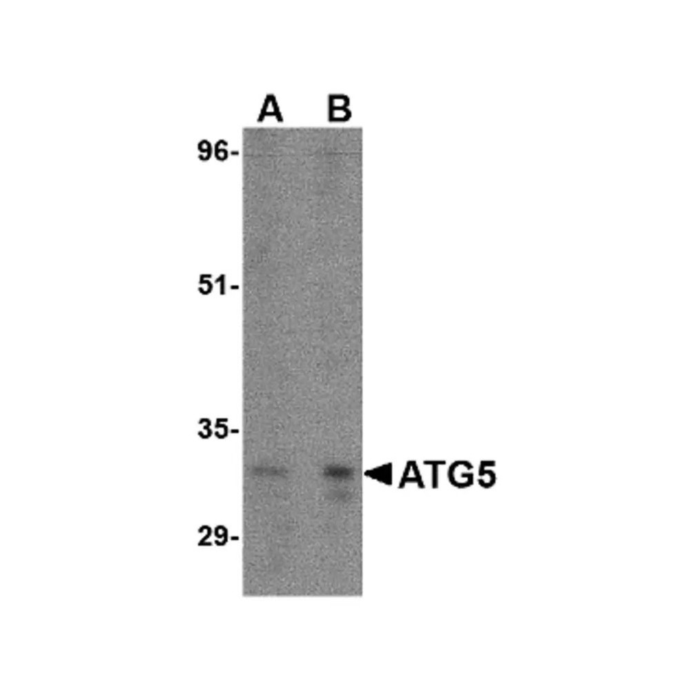 ProSci 4441 ATG5 Antibody