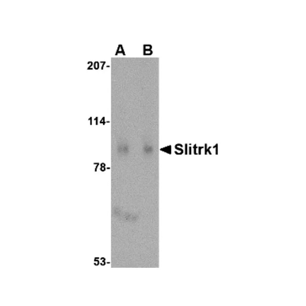 ProSci 4453 Slitrk1 Antibody