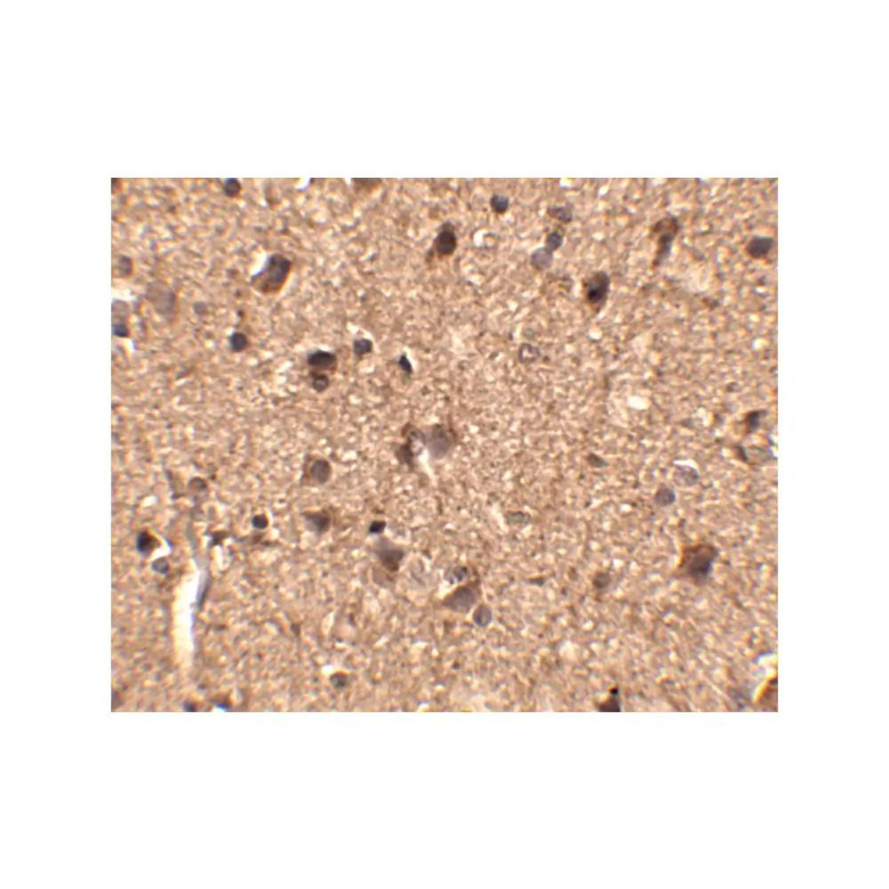 ProSci 4455 Slitrk1 Antibody