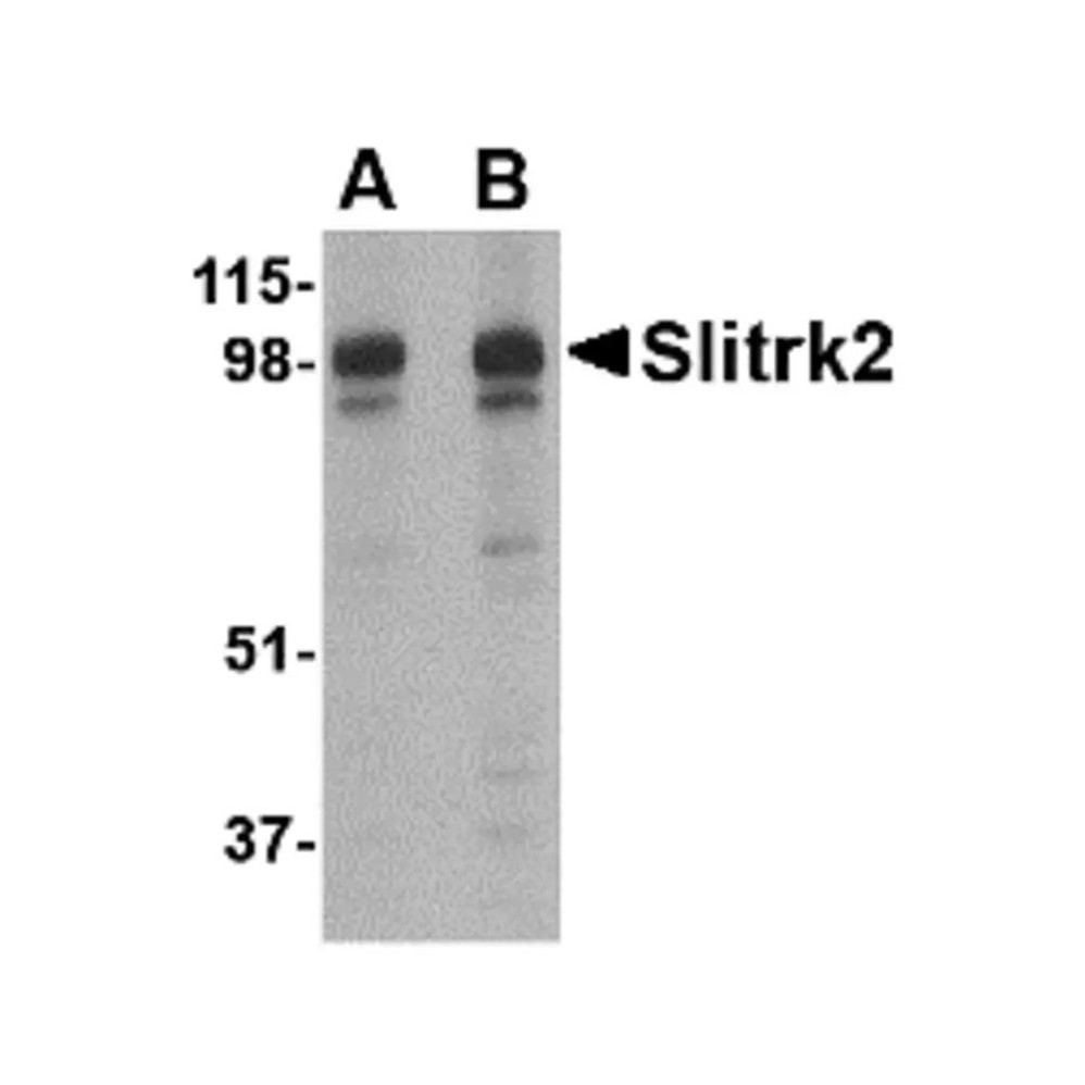 ProSci 4457 Slitrk2 Antibody