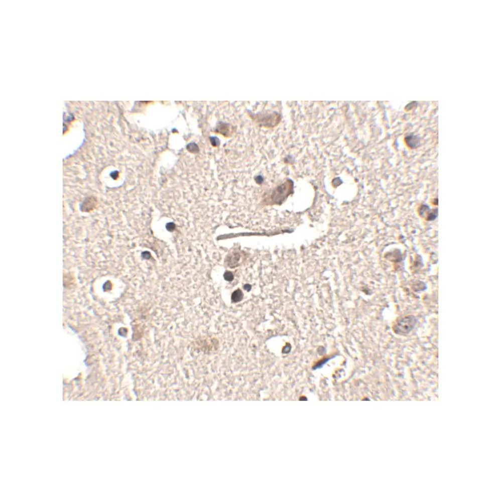ProSci 4459 Slitrk2 Antibody