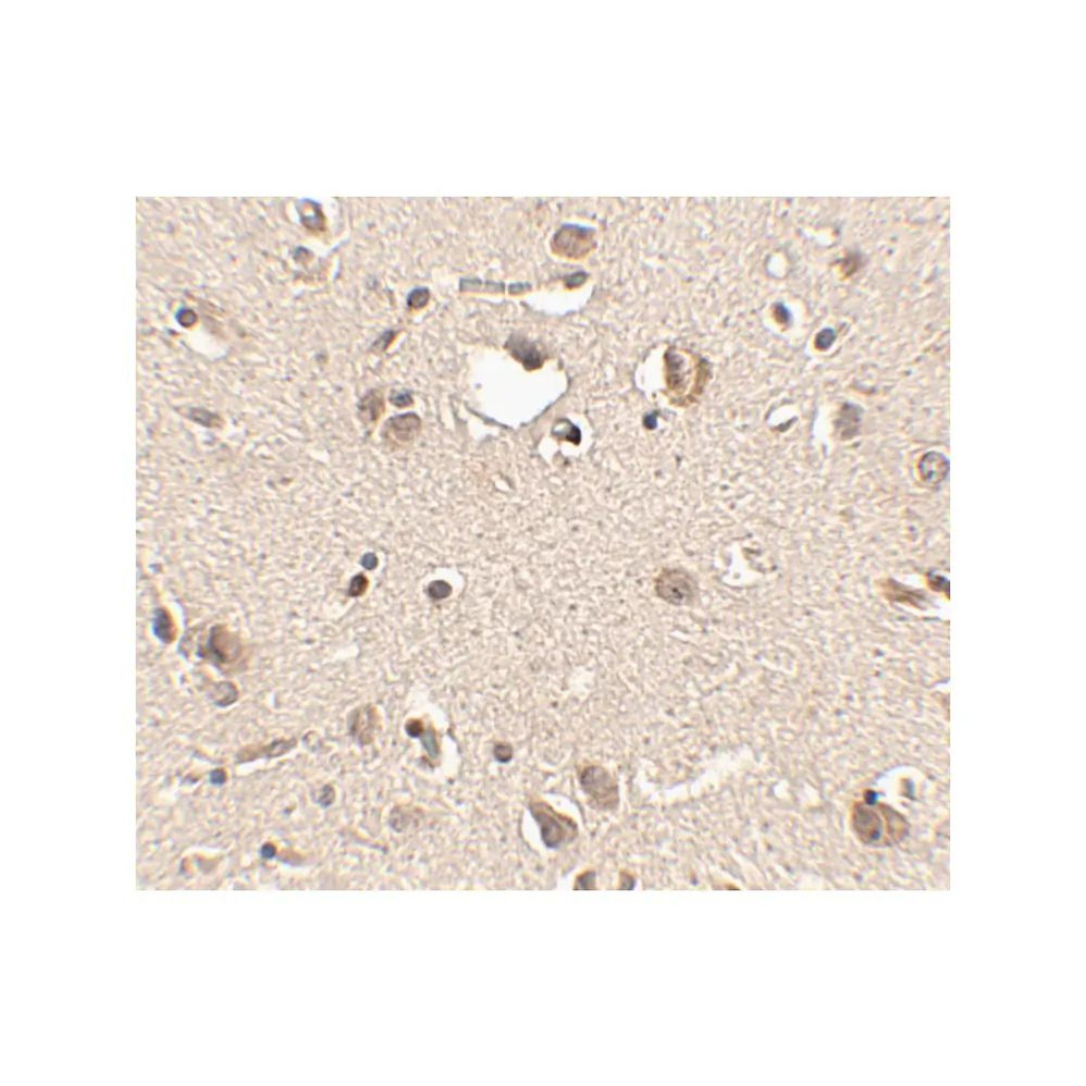 ProSci 4463 Slitrk3 Antibody