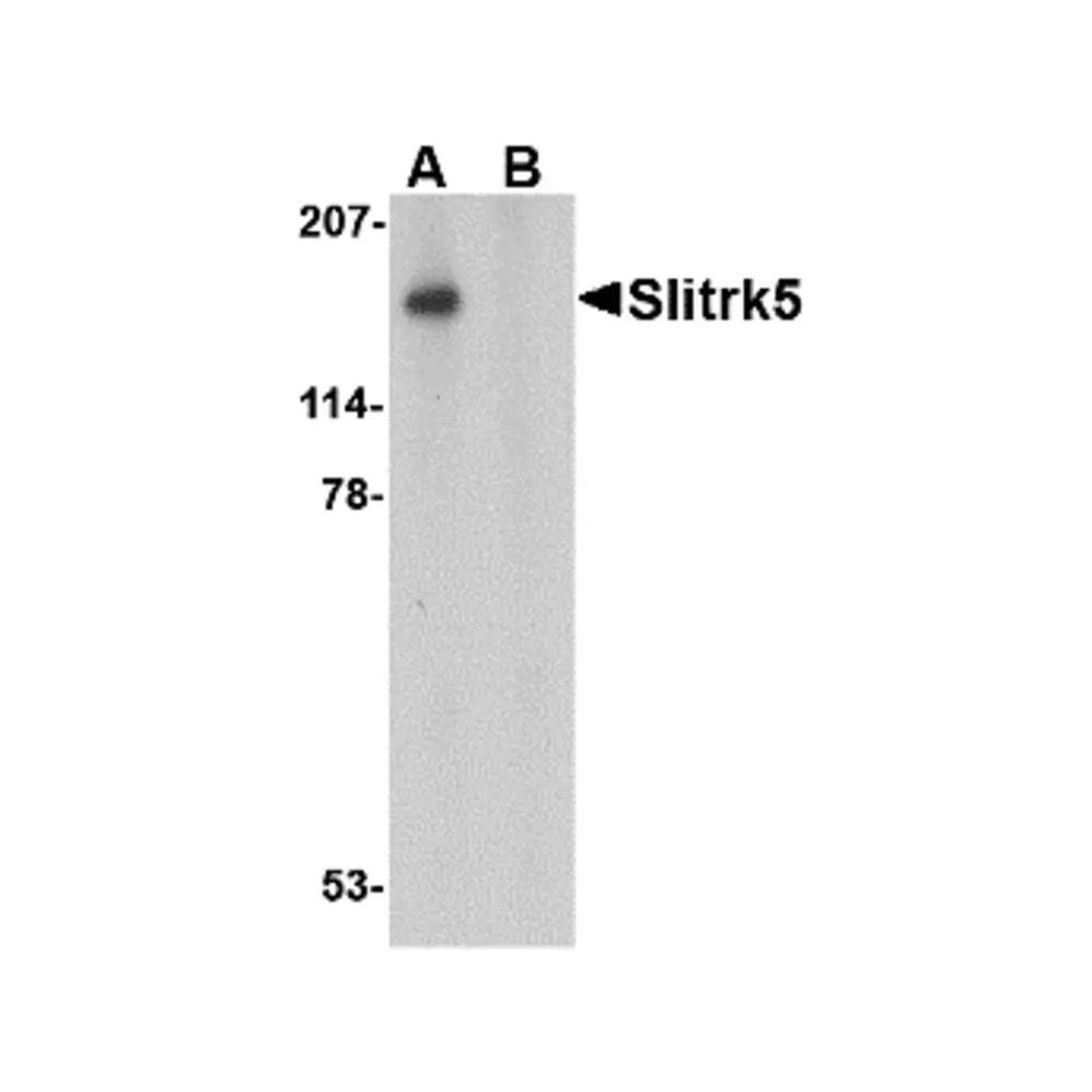 ProSci 4475 Slitrk5 Antibody
