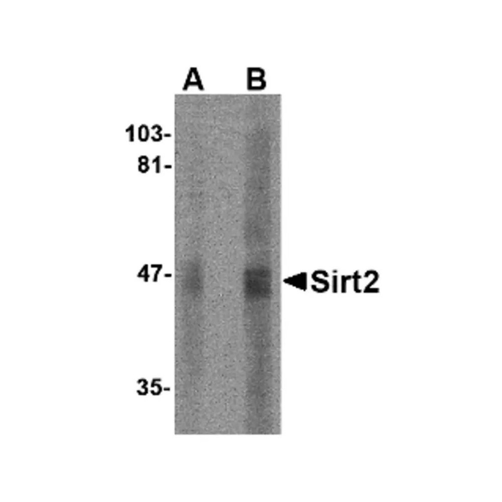 ProSci 4487 SIRT2 Antibody
