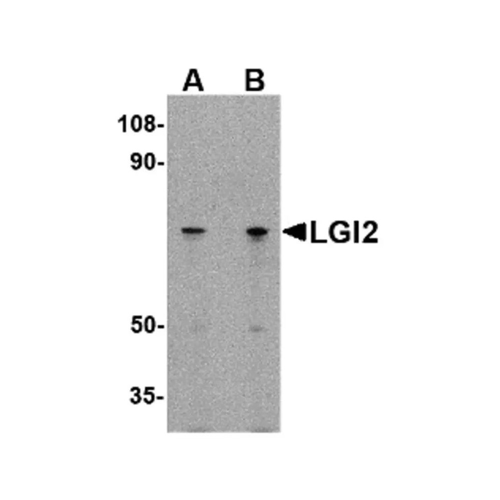 ProSci 4491 LGI2 Antibody