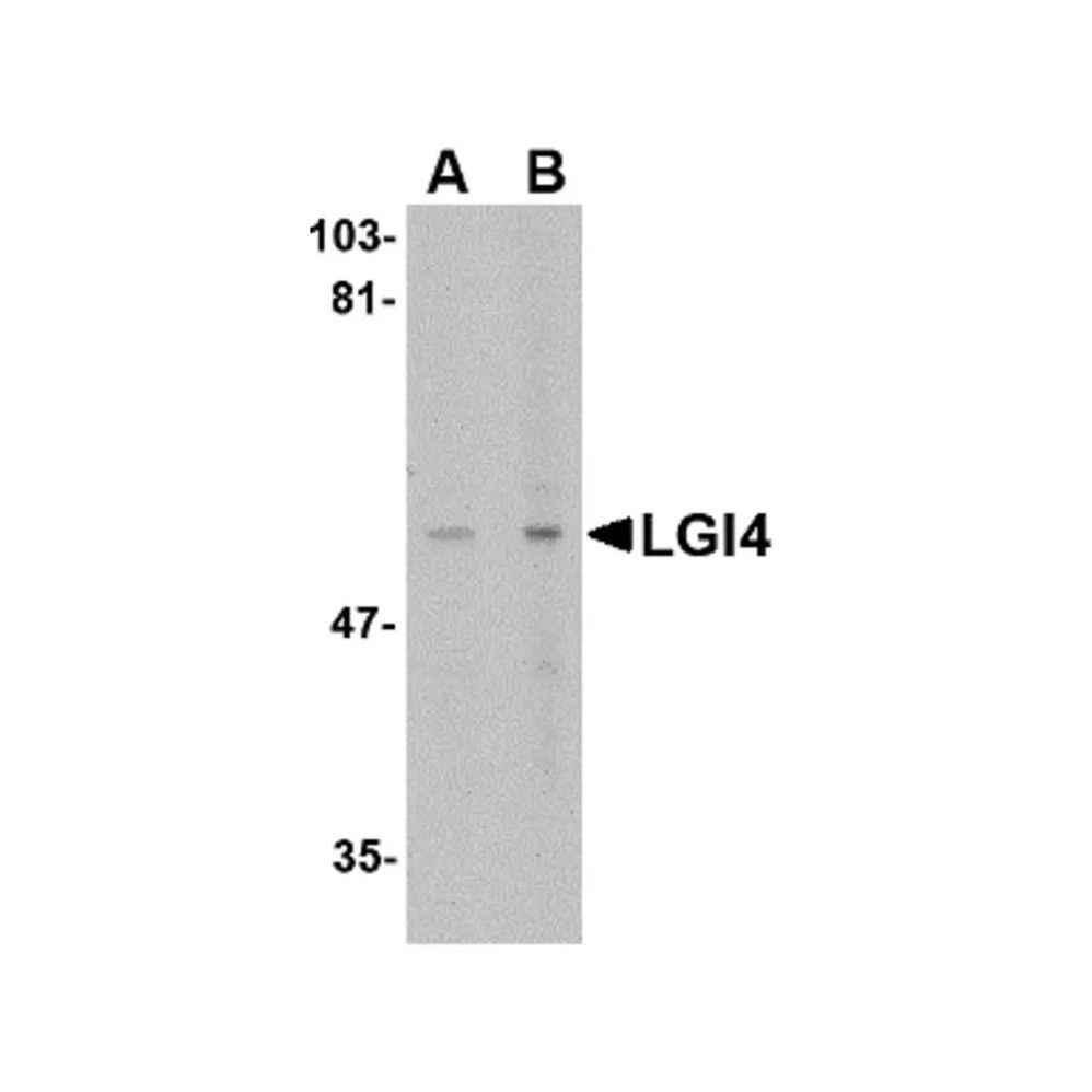 ProSci 4511 LGI4 Antibody