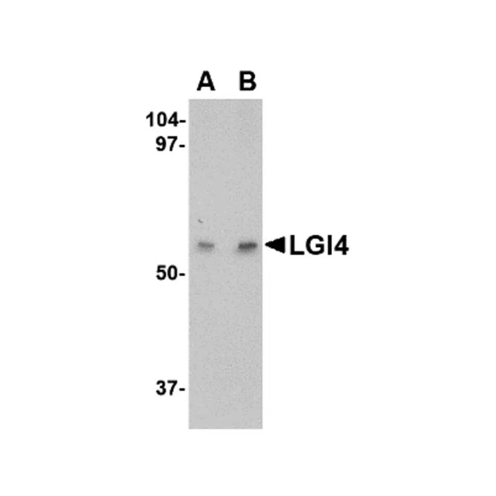 ProSci 4513 LGI4 Antibody