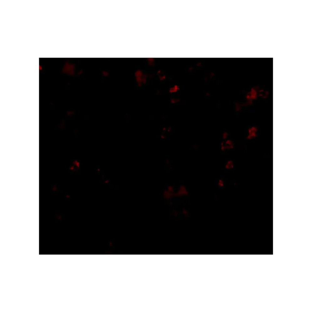 ProSci 4549 EVER1 Antibody