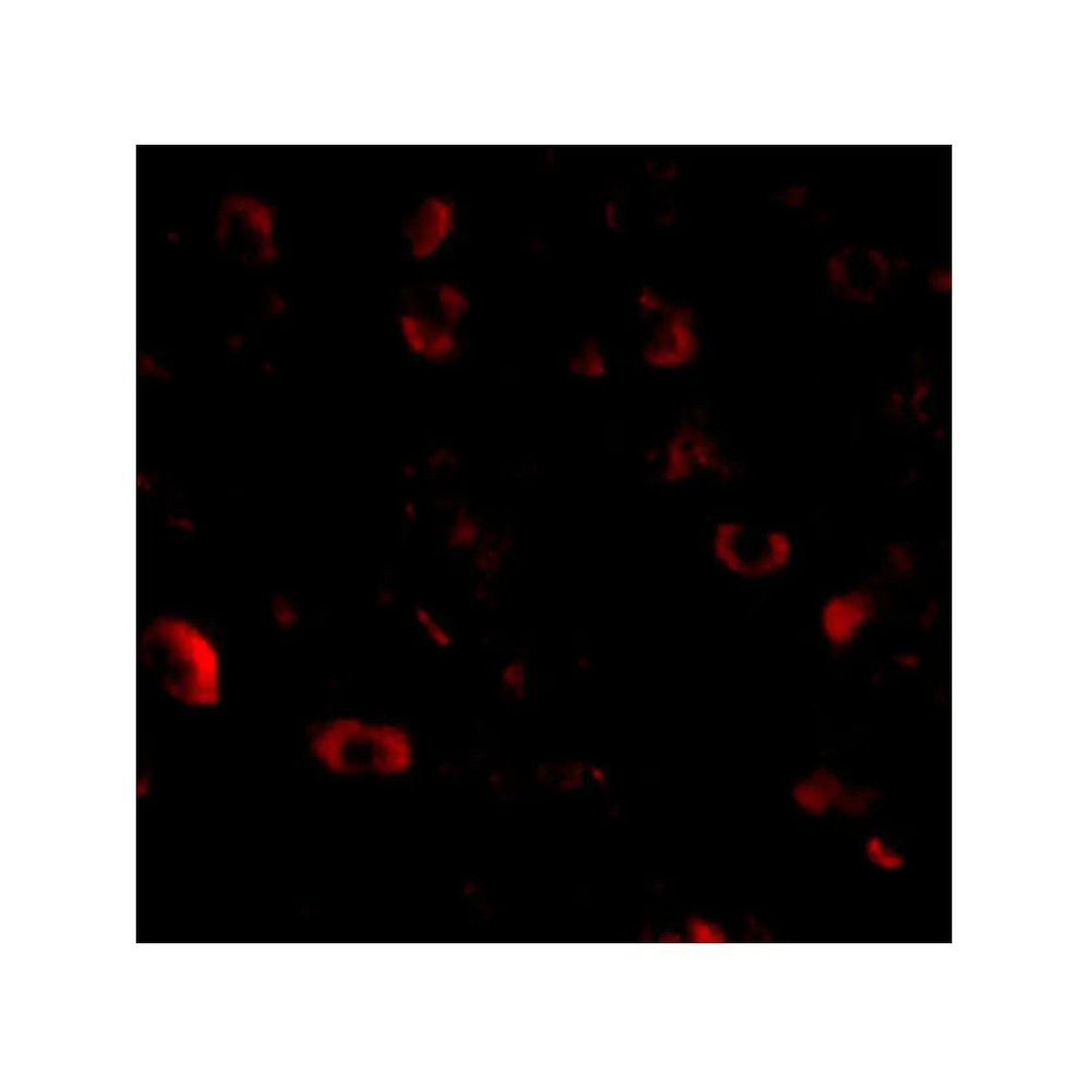 ProSci 4561 CAPS1 Antibody