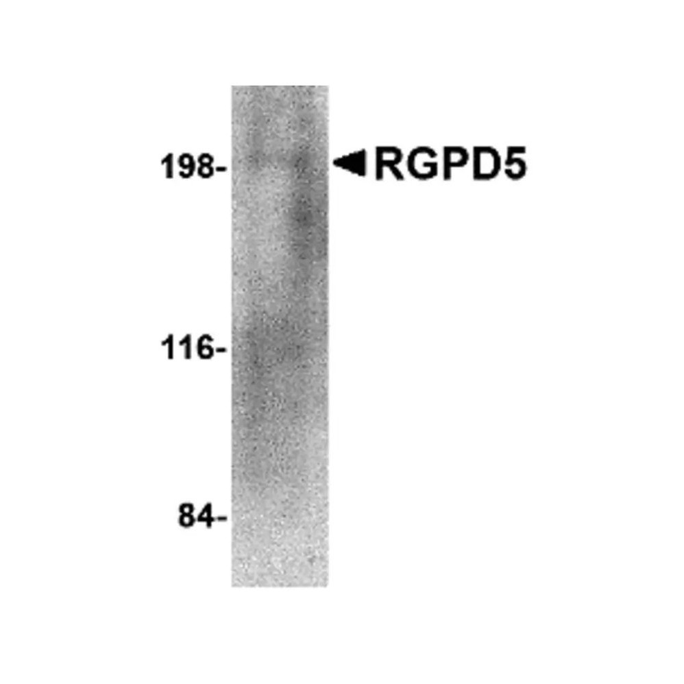 ProSci 4585 RGPD5 Antibody