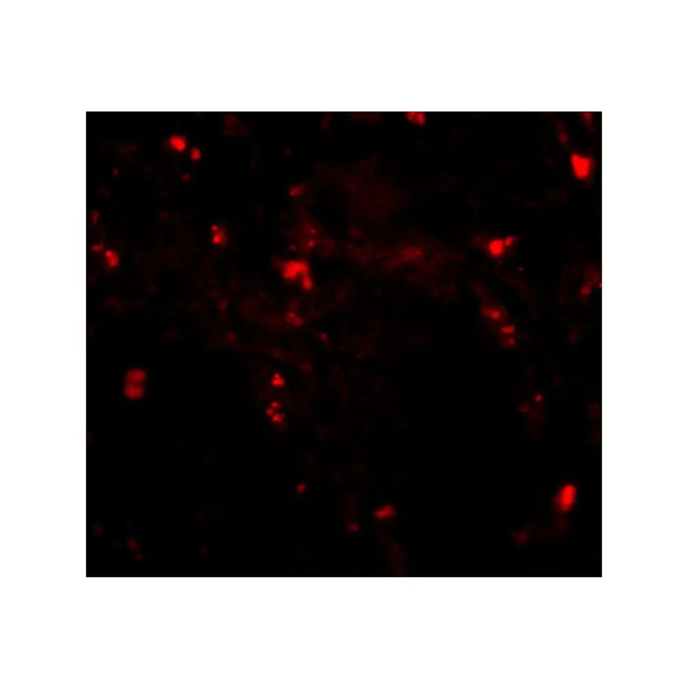 ProSci 4585 RGPD5 Antibody