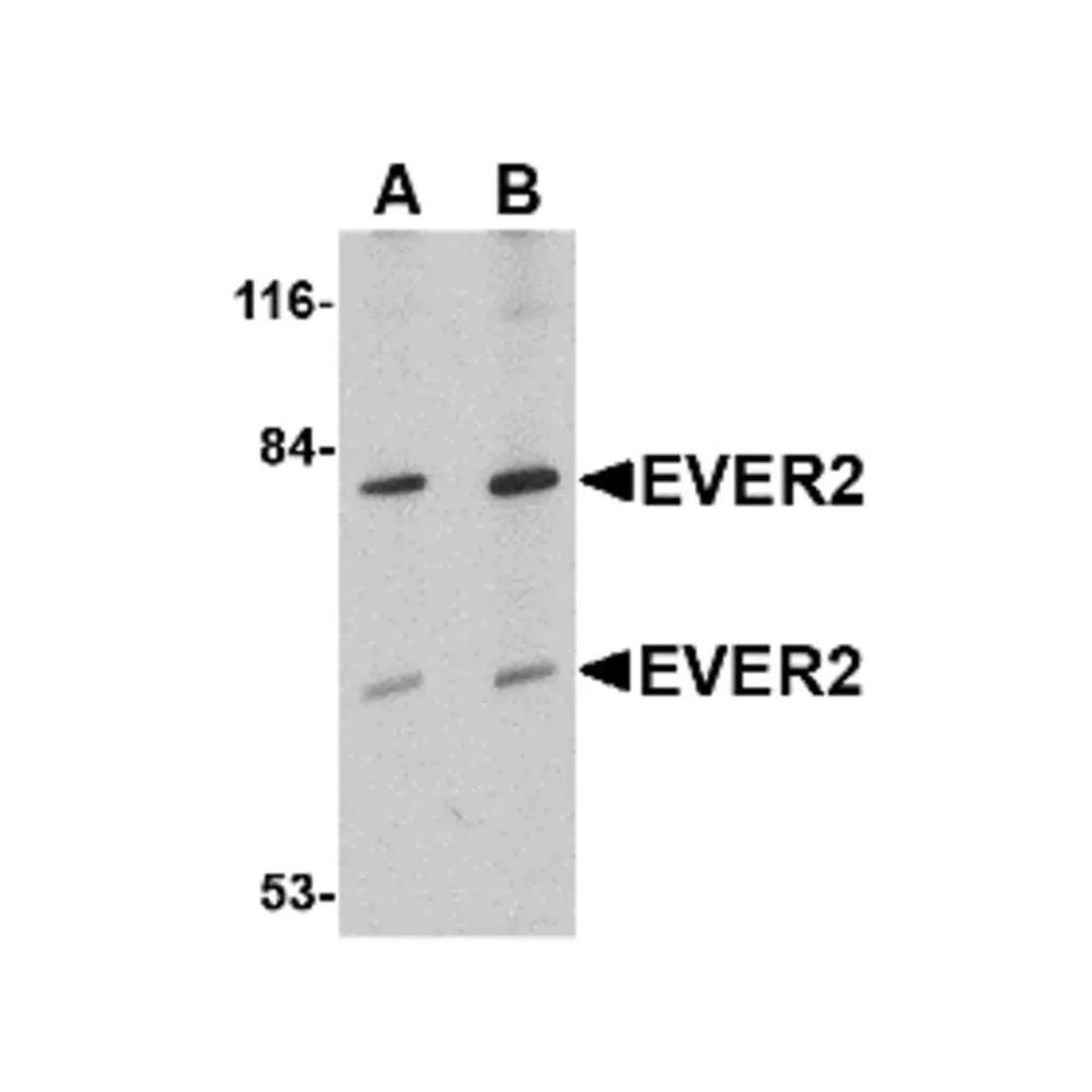 ProSci 4605 EVER2 Antibody