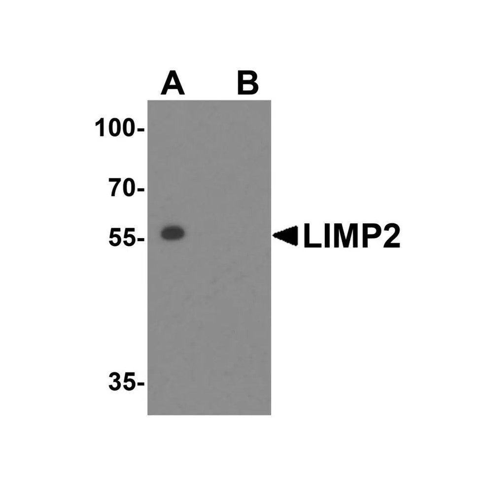 ProSci 4621 LIMP2 Antibody