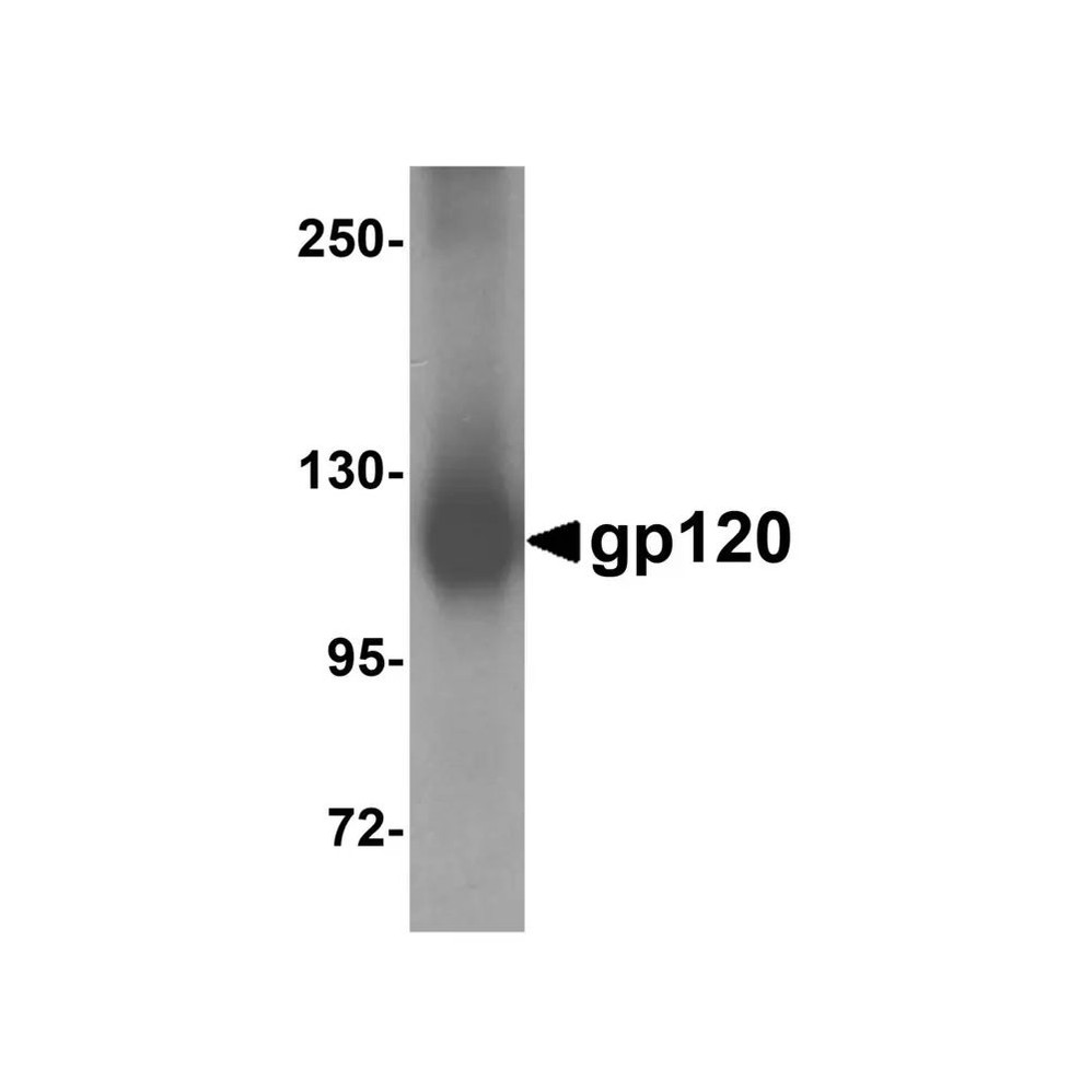 ProSci 4641 gp120 Antibody