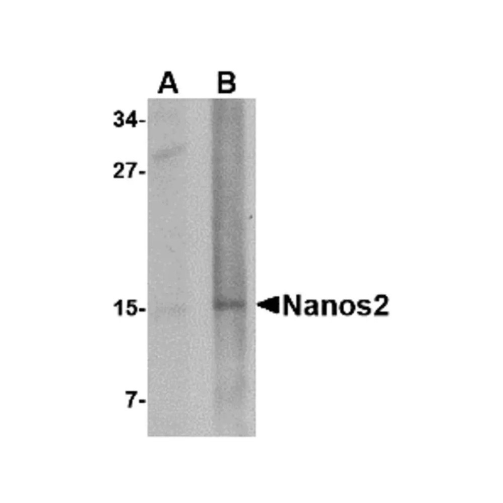 ProSci 4647 Nanos2 Antibody