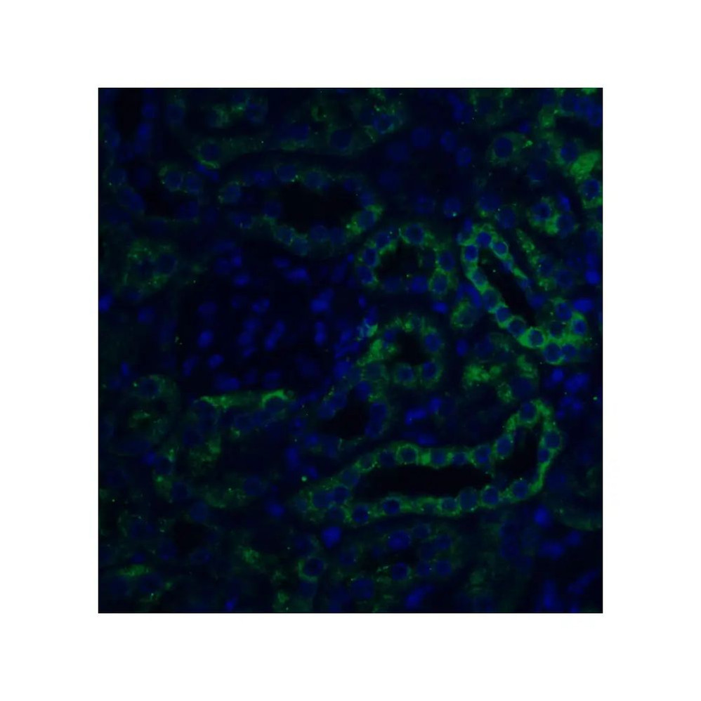 ProSci 4651 Slc22A17 Antibody