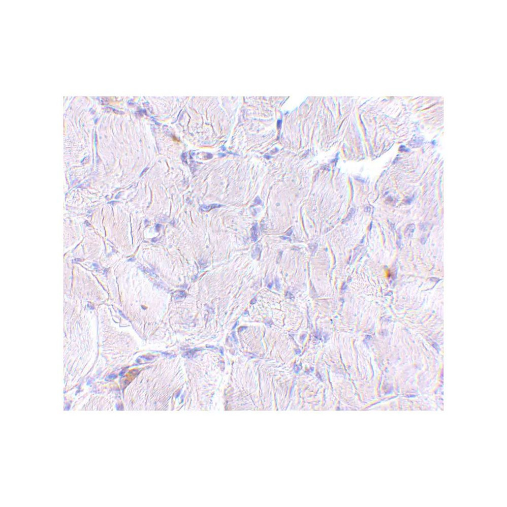 ProSci 4655 LIMP2 Antibody