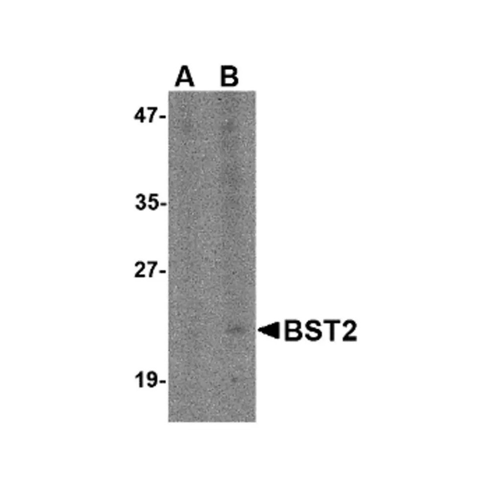 ProSci 4661 Bst2 Antibody