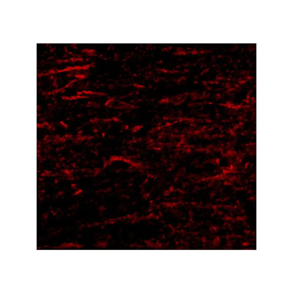 ProSci 4679 SATB1 Antibody