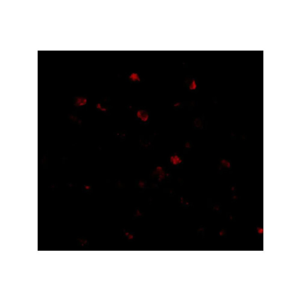 ProSci 4707 NUP160 Antibody