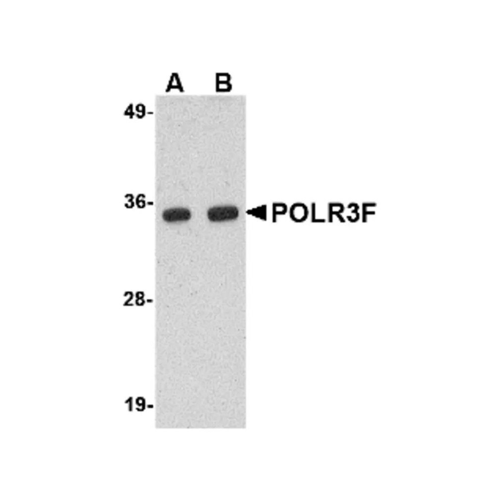 ProSci 4727 POLR3F Antibody