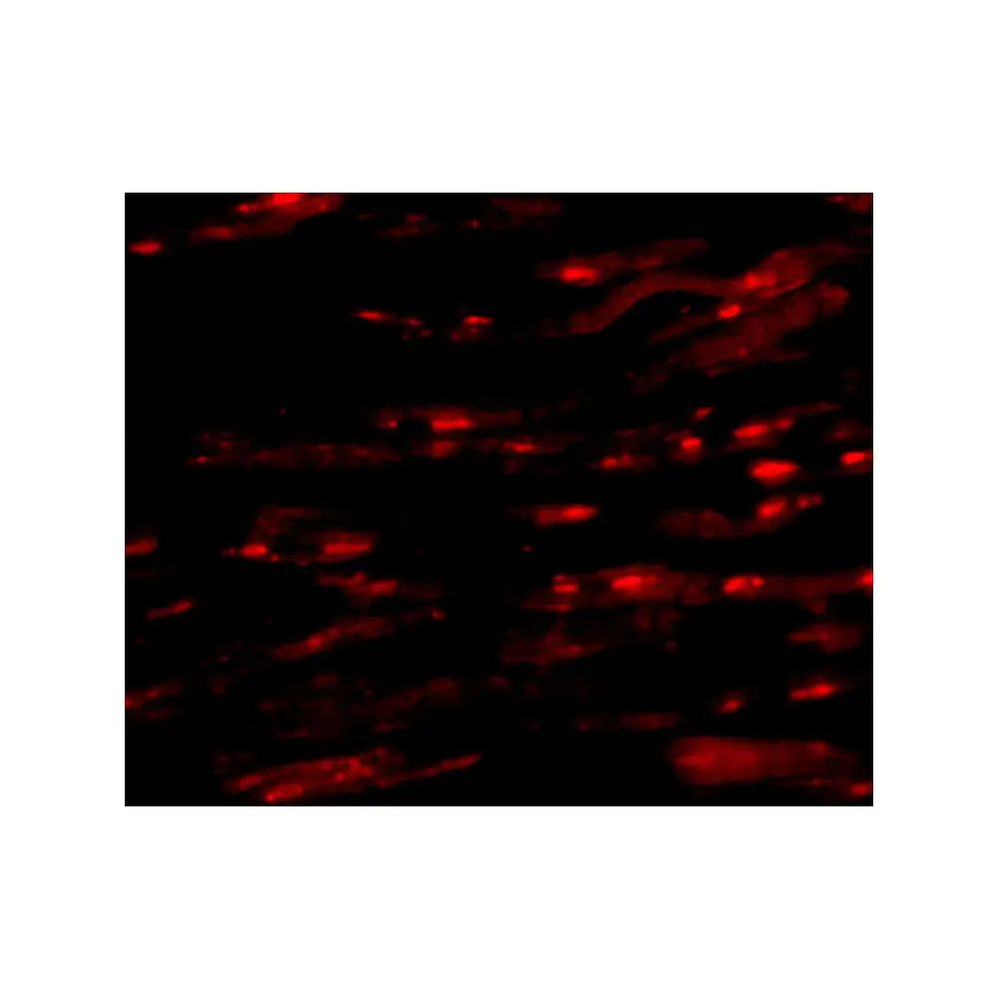 ProSci 4741 ASAH1 Antibody