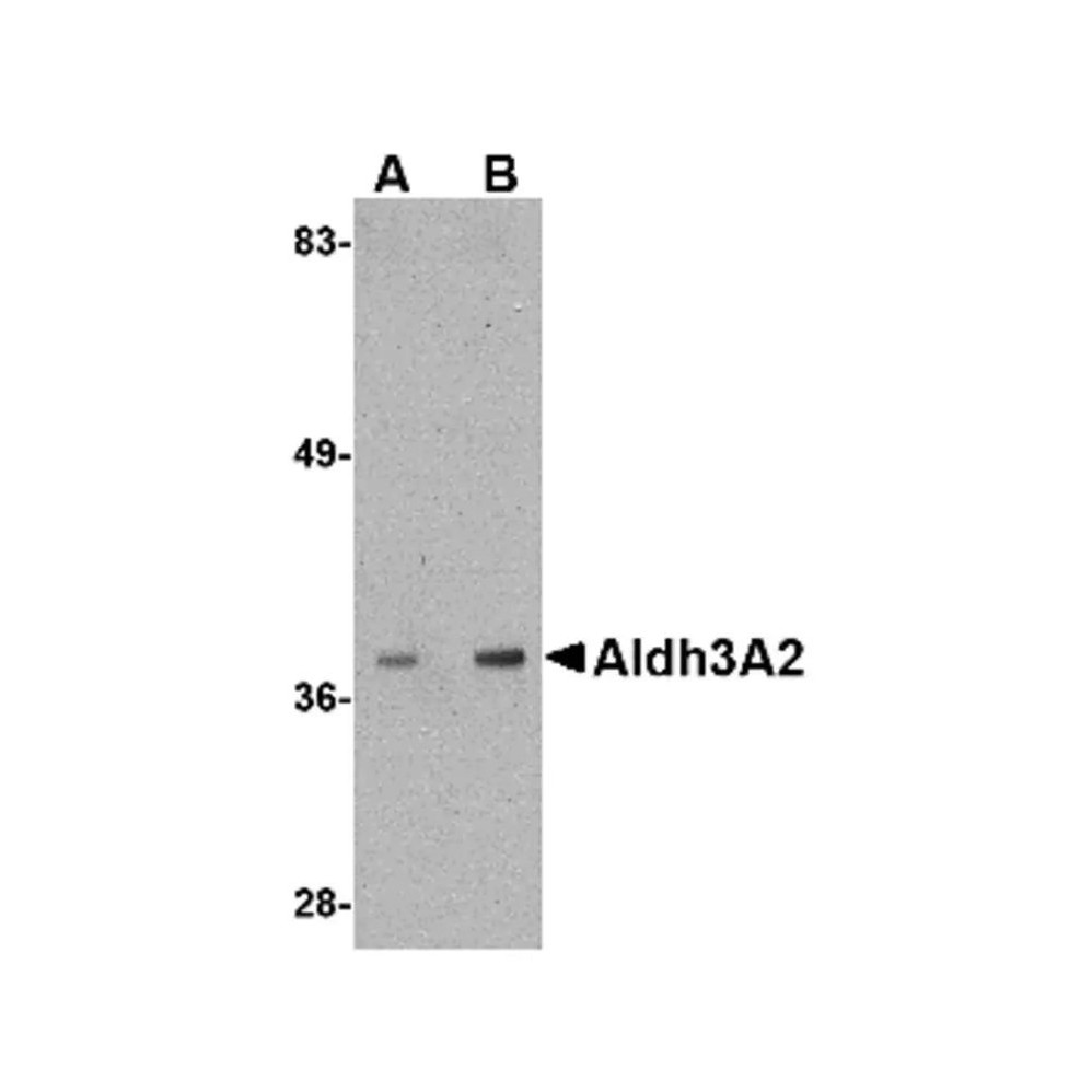 ProSci 4789 Aldh3A2 Antibody