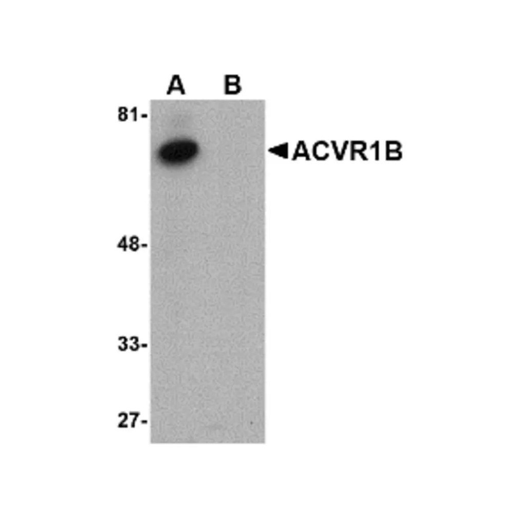 ProSci 4793 ACVR1B Antibody