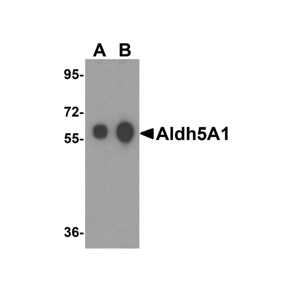 ProSci 4807 Aldh5A1 Antibody