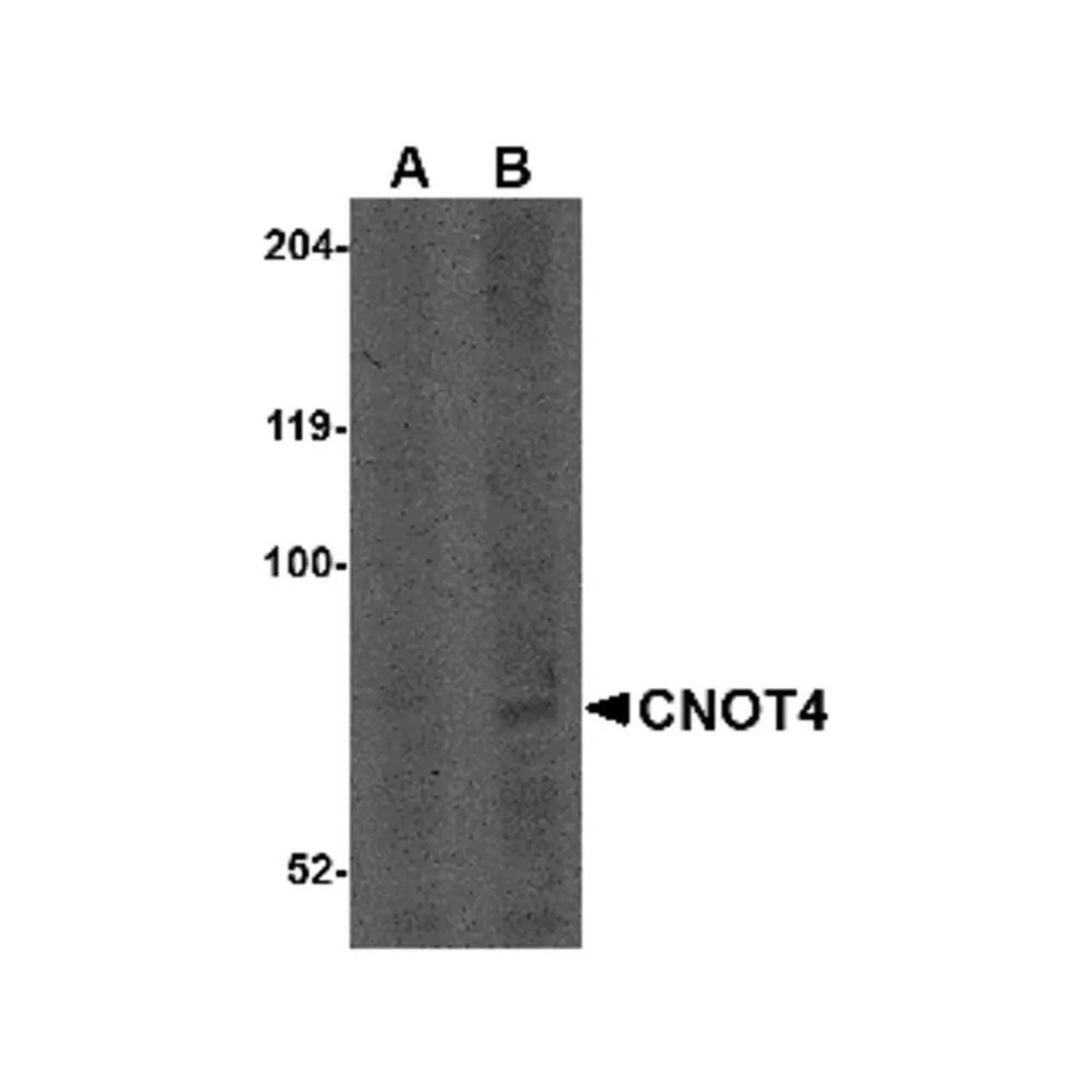 ProSci 4813 CNOT4 Antibody