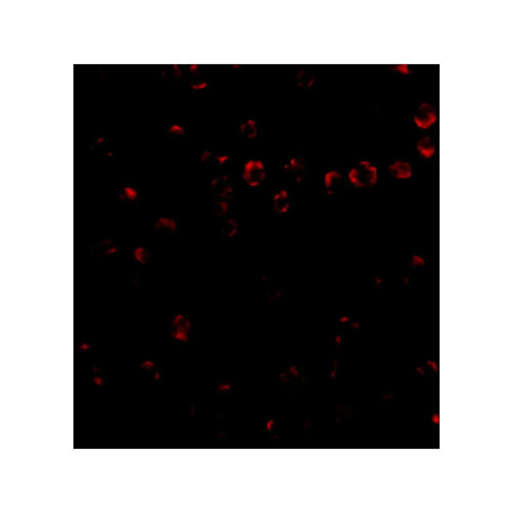 ProSci 4827 Integrin alpha 4 Antibody