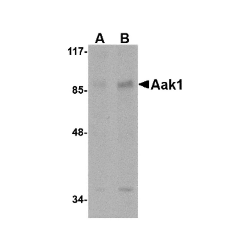 ProSci 4831 Aak1 Antibody